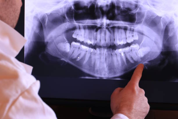 Best Emergency Broken Tooth Repair in Hot Springs Village, AR